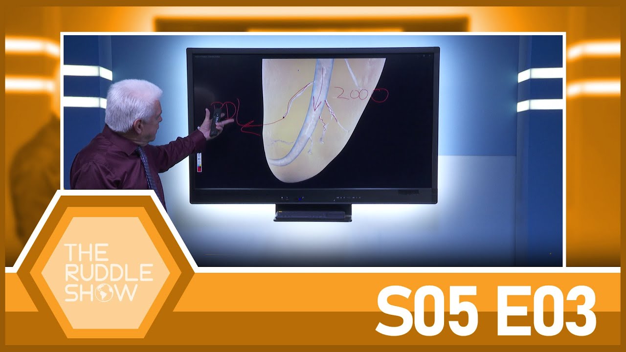 S05 E03 - EndoActivator History & Technique: How the EndoActivator Came to Market & How to Use It