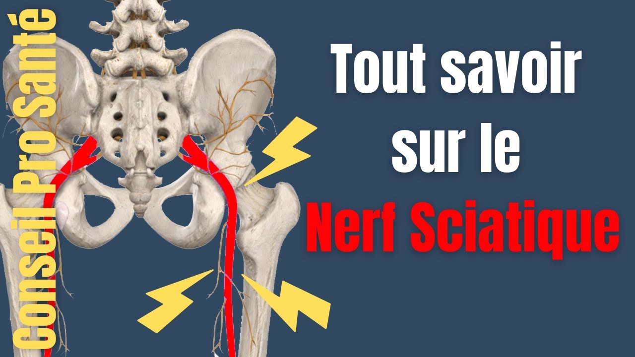 Tout savoir sur le nerf Sciatique : Origine, trajet, fonctions