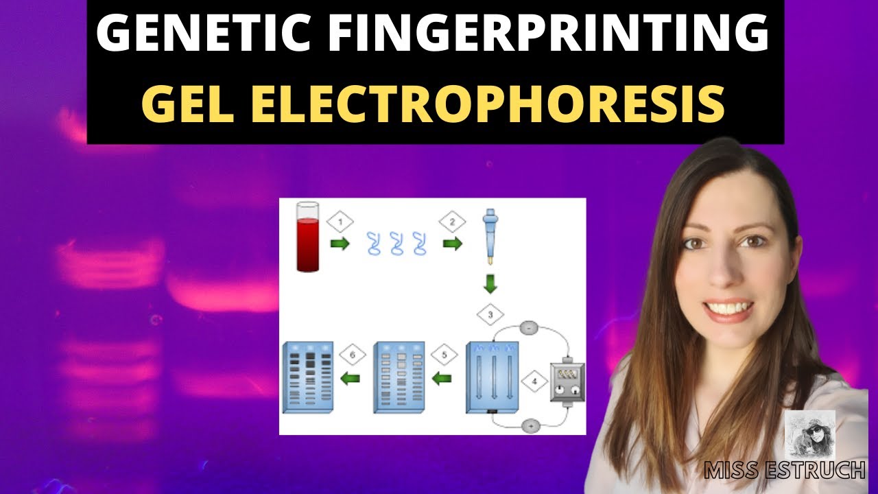 GENETIC FINGERPRINTING- A-level Biology. Gel electrophoresis, VNTRs and the uses.