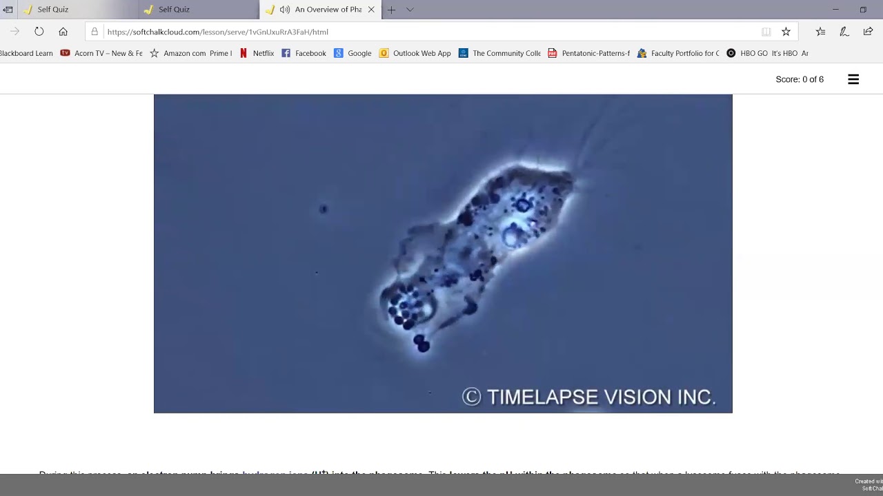 Overview of phagocytosis, the complement pathways, and antibacterial peptides