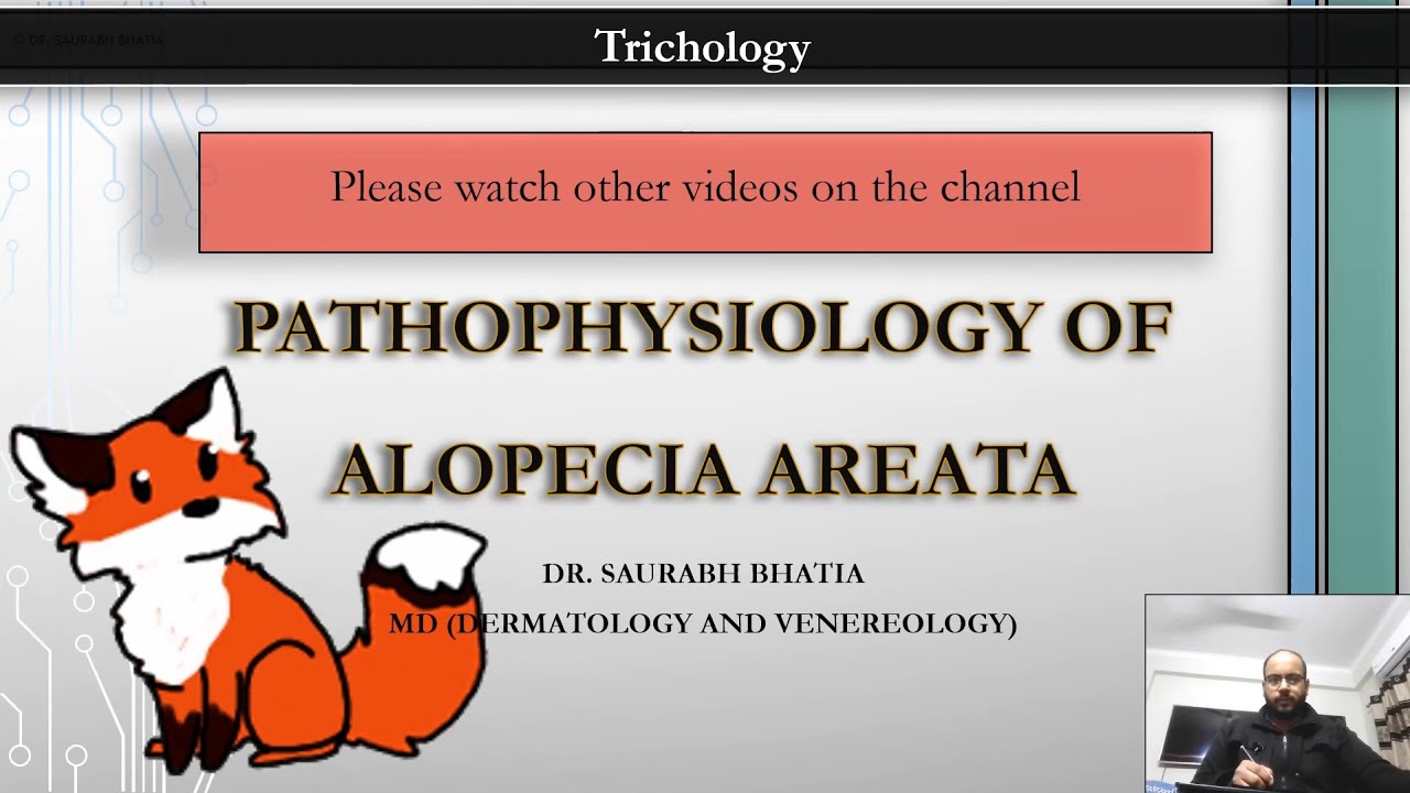 Pathophysiology of Alopecia Areata: Pathomechanisms, theories, immunopathologies