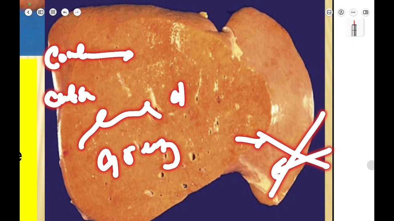 Intro of practical pathology 