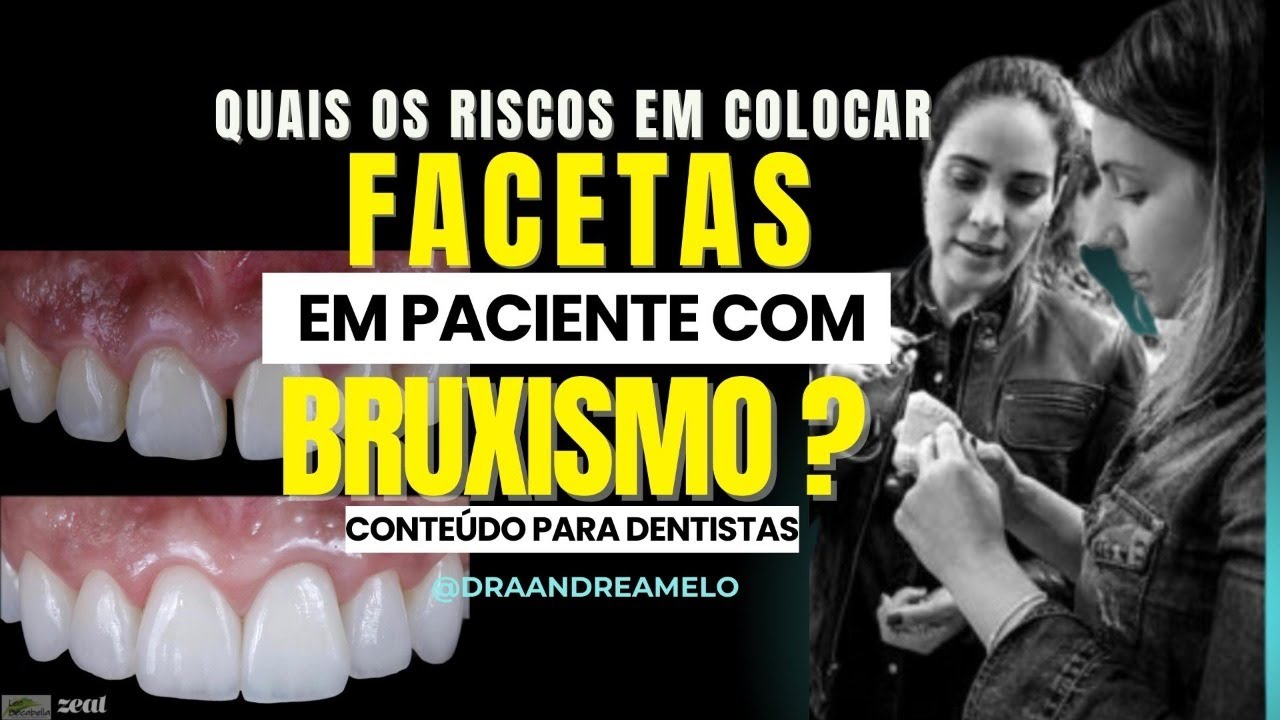 Quais os riscos de colocar facetas em pacientes com Bruxismo?