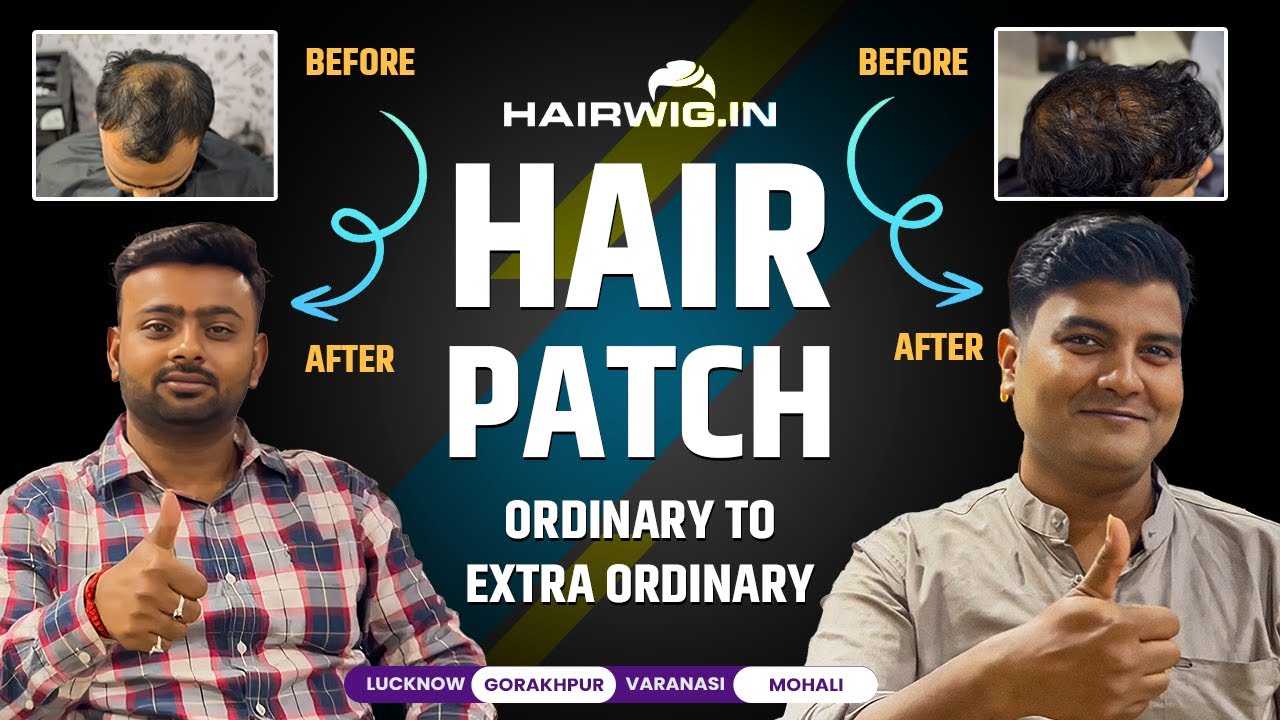 Hairpatch | HappyClient #PinkiSingh #rizwan #hairwig #lucknow #varanasi #trending #viral #shorts