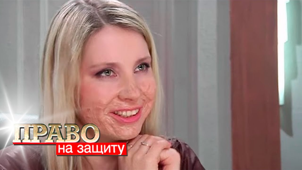 Право на защиту: Кислота