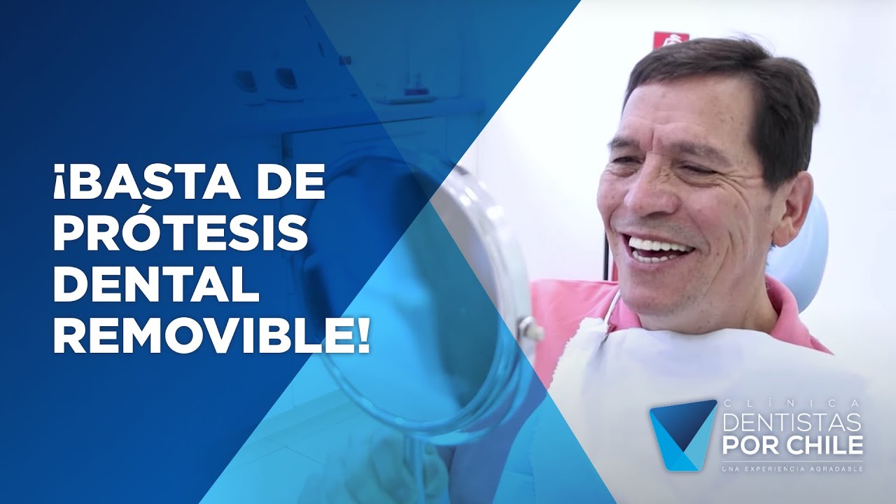 ¡Basta de prótesis dental removible! Fue lo que dijo Don René y escogió sus implantes dentales.