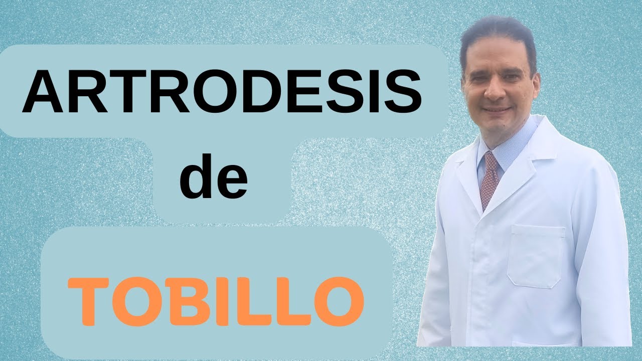 ARTRODESIS DE TOBILLO #juancalbornoz #artrodesisdetobillo #doctorjuancarlosalbornoz