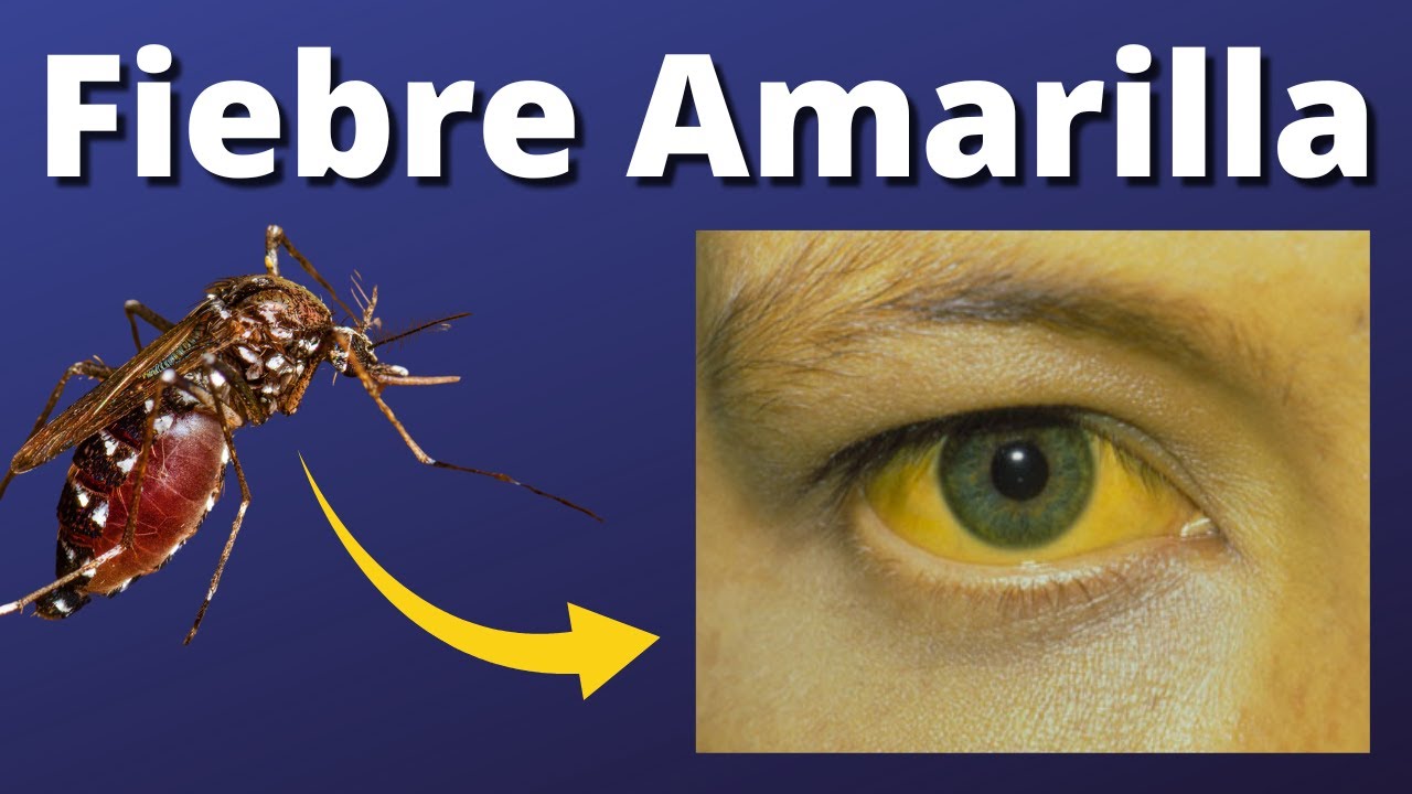 Fiebre Amarilla Explicada Claramente
