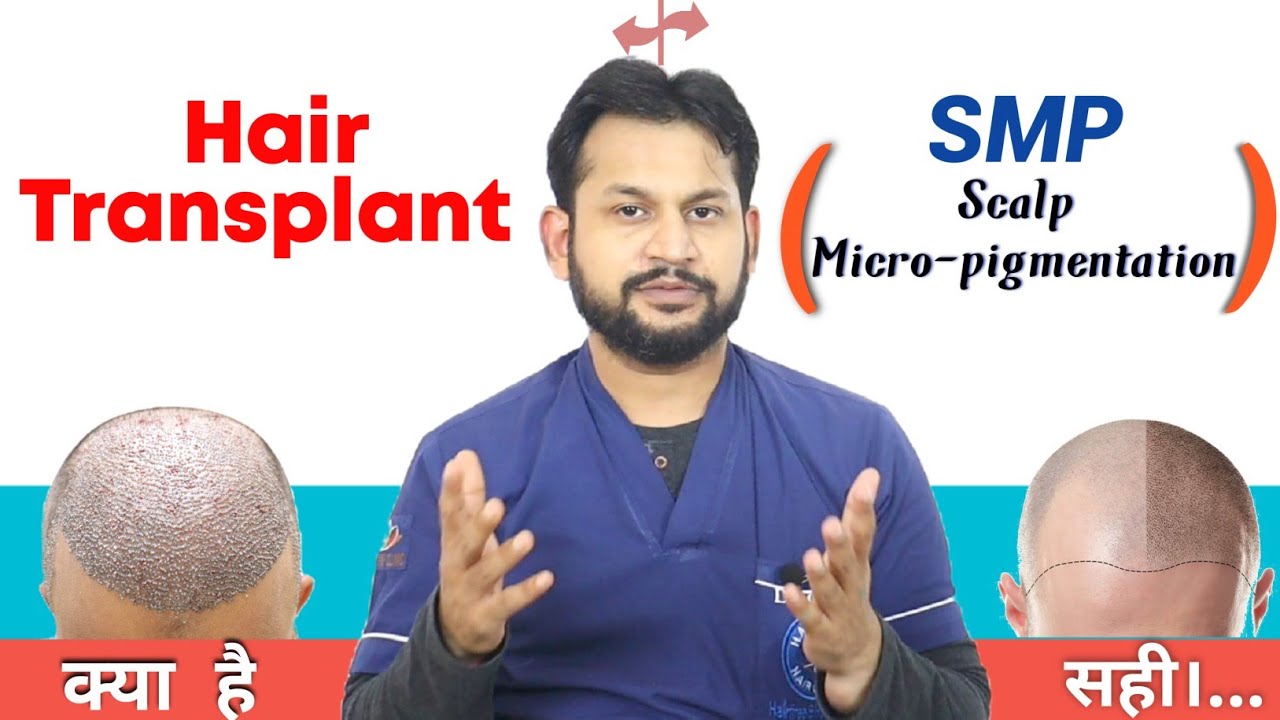 Hair Transplant 