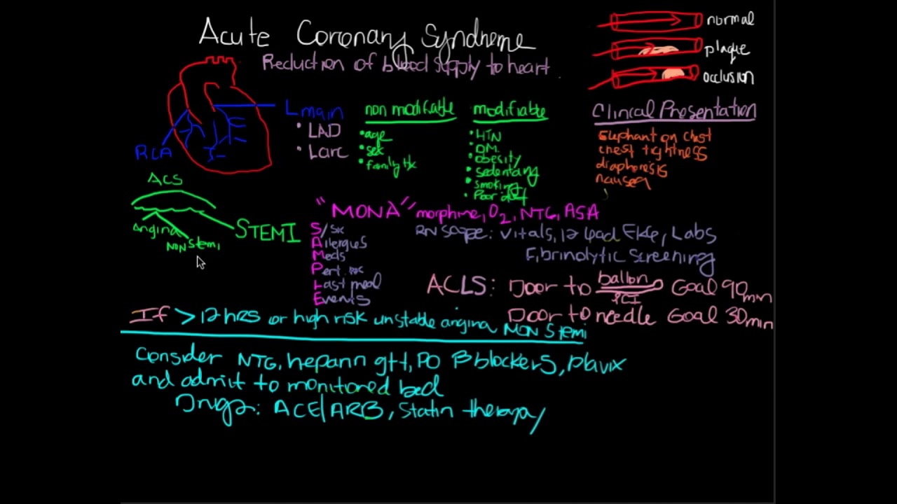 STEMI Chest Pain, Clinical Presentation