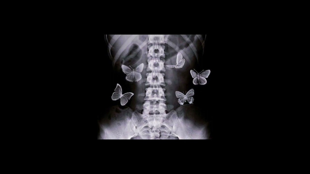 T. Danny - Talán [ speed up ] [tiktok: norbertooooxd]