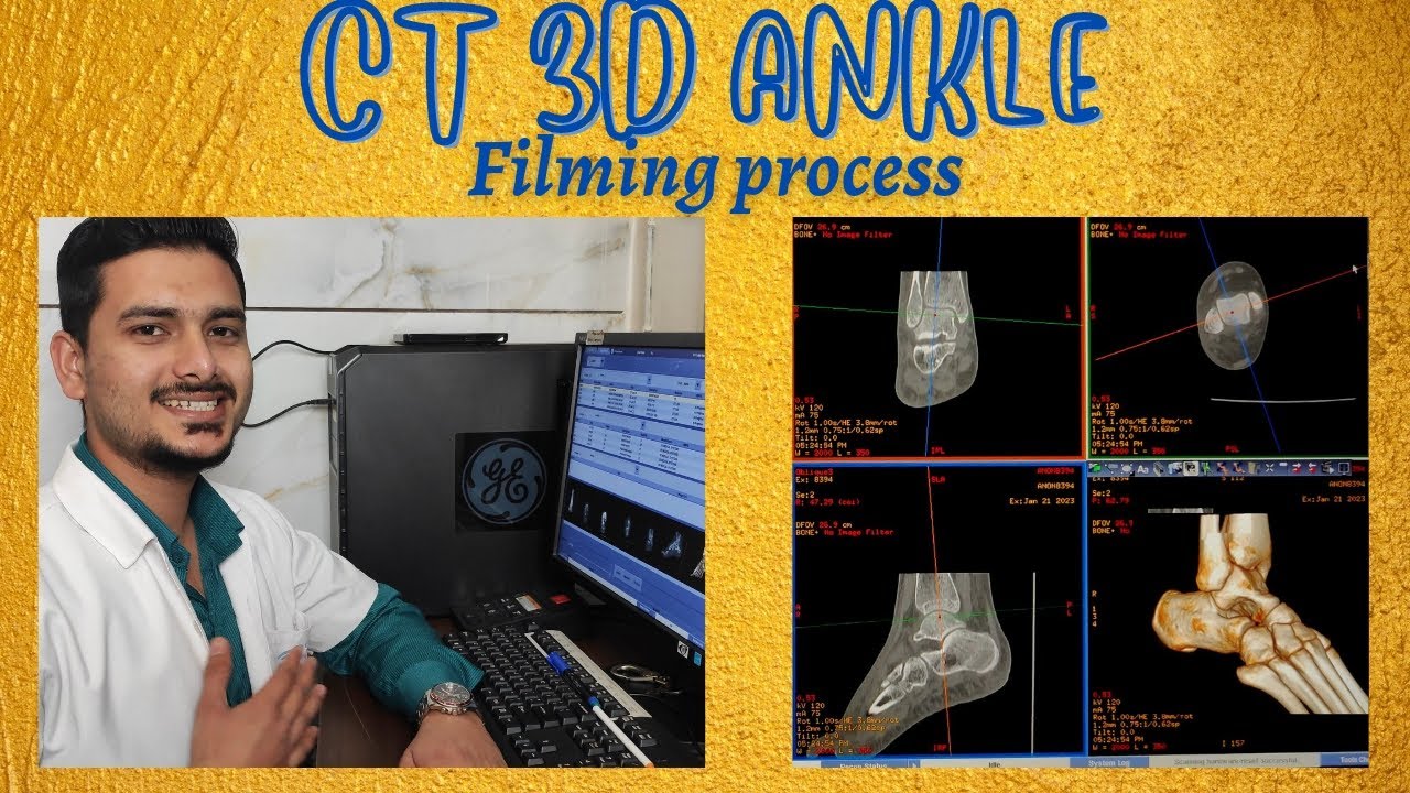 CT Scan 3D Ankle joint filming process on GE REVOLUTION machine | Tarsal bone filming technique.