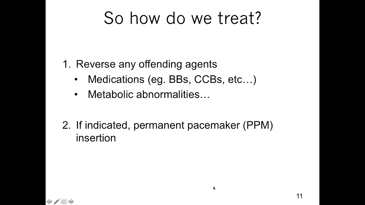 Treatment of Arrhythmias: Part 1