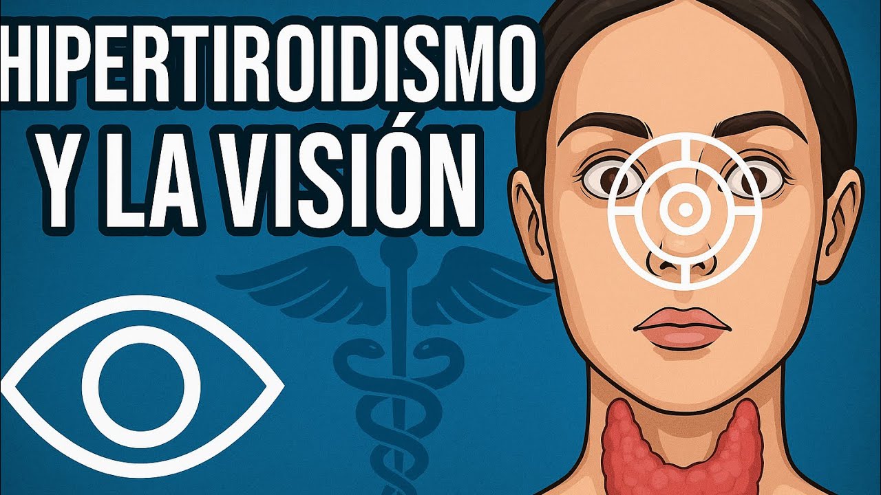¿Ojos saltones? Alerta con estos síntomas del hipertiroidismo! 🤯
