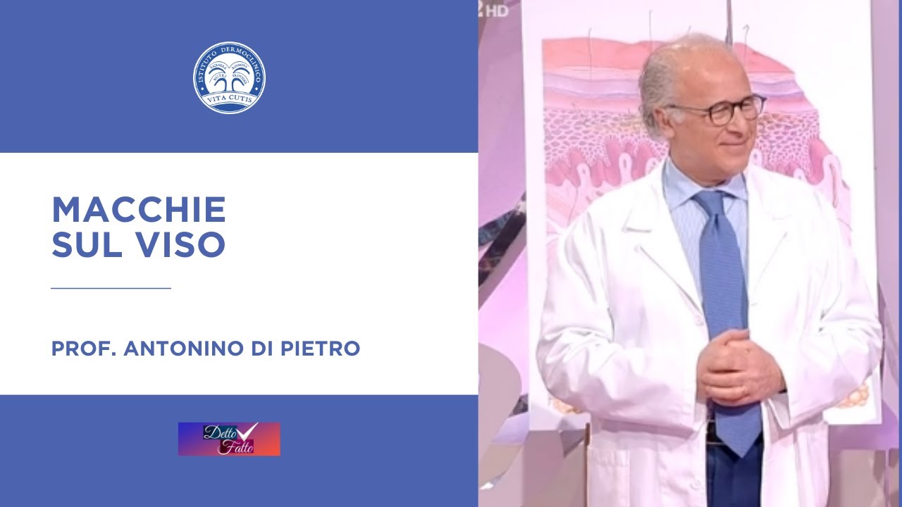 Macchie sul viso
