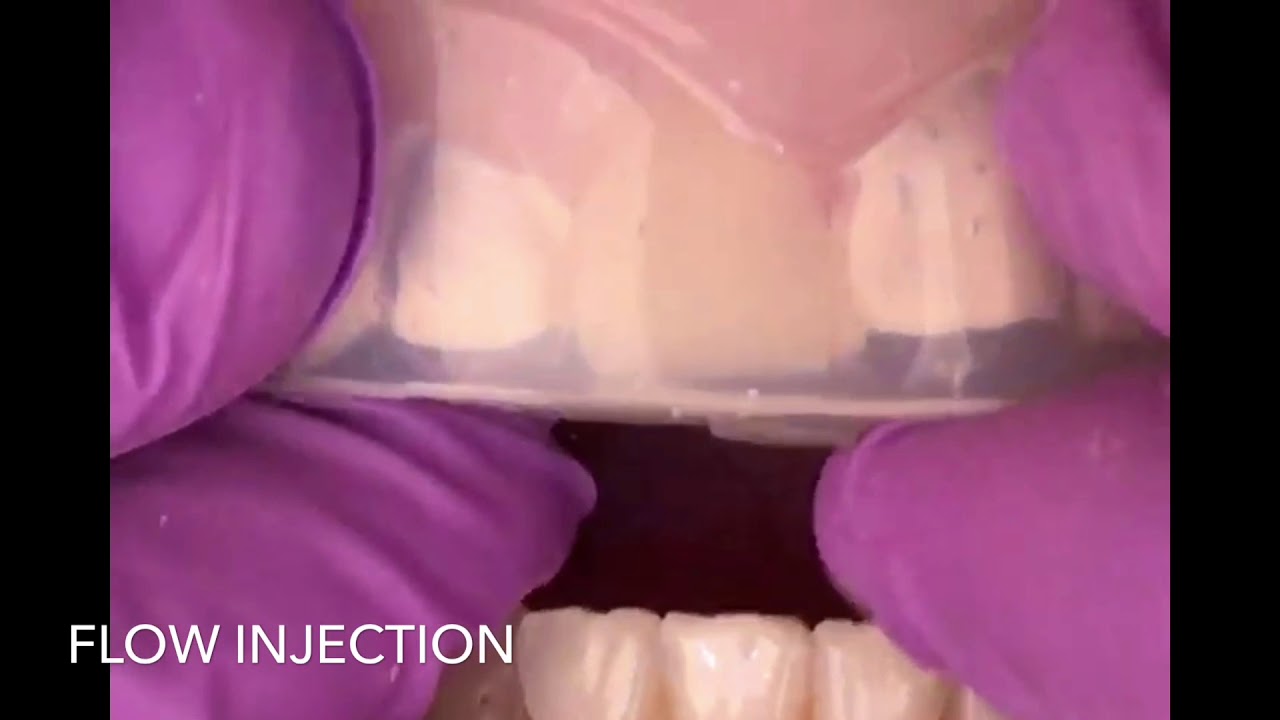 flow injection technique