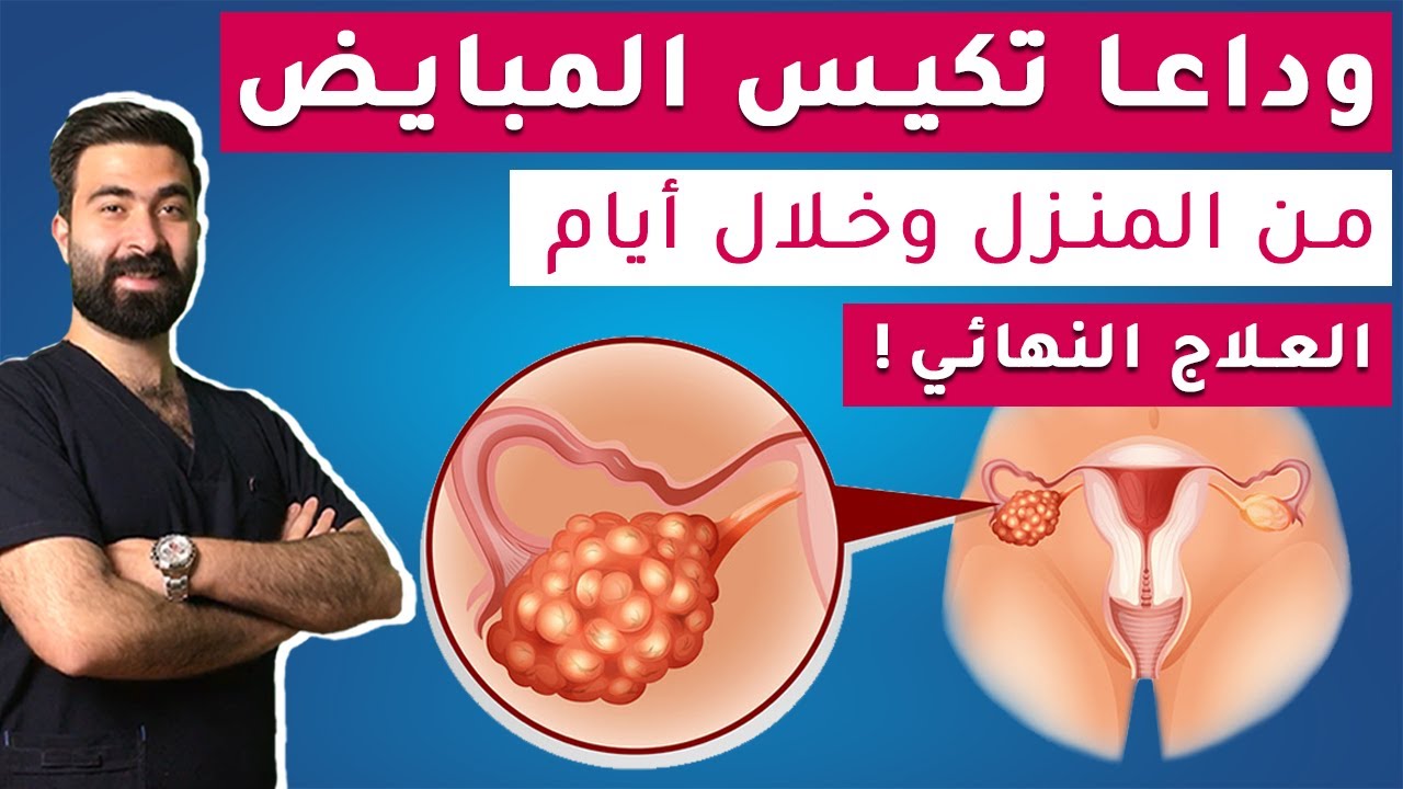 لماذا تصابي بتكيس المبايض ؟ الاعراض + العلاج النهائي | تكيس المبايض والحمل ! || مقاومة الانسولين
