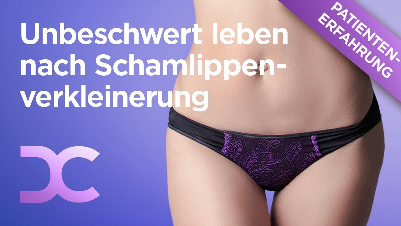 Schamlippenverkleinerung: Erfahrung nach Labienplastik in der Dorow Clinic | Intimchirurgie