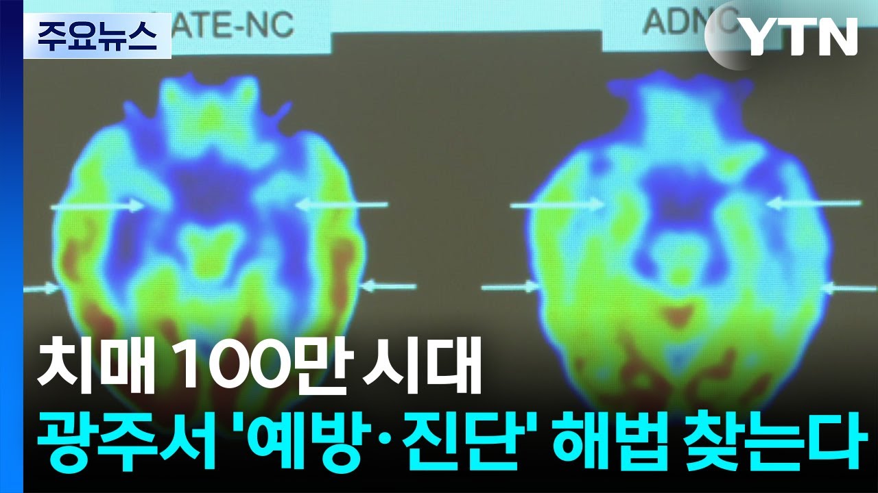 치매 100만 시대...광주서 ’예방·진단’ 해법 찾는다 / YTN