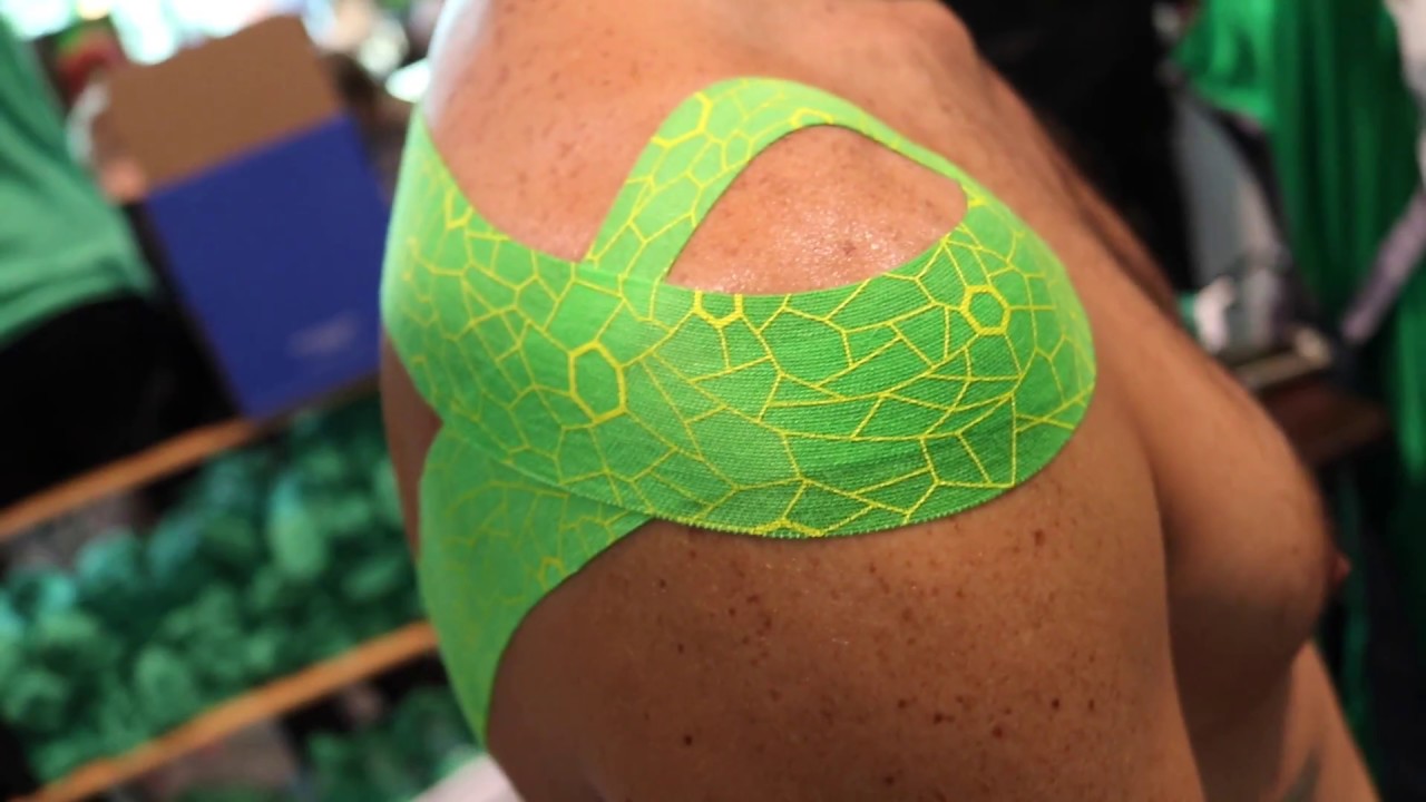 How to Heal Rotator Cuff Injuries with Soft Tissue Treatments, Exercise and Kinesiology Tape