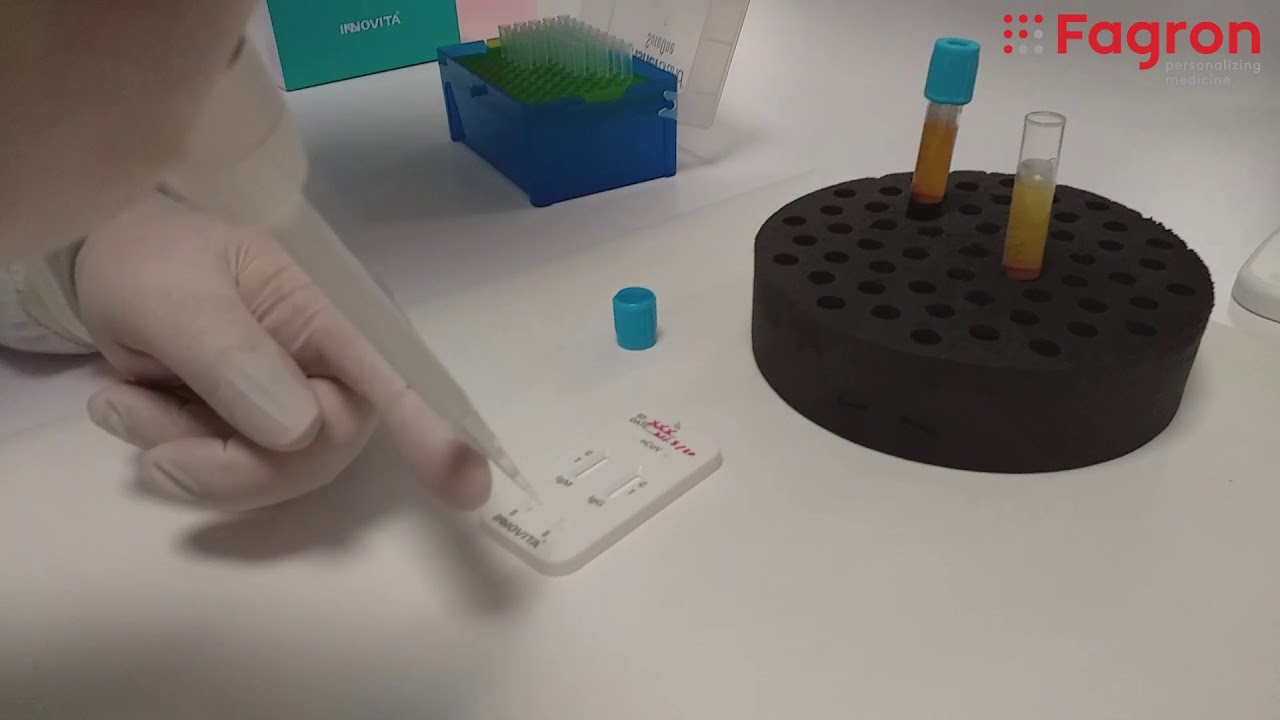 C&oacute;mo realizar los test serol&oacute;gicos o test r&aacute;pidos