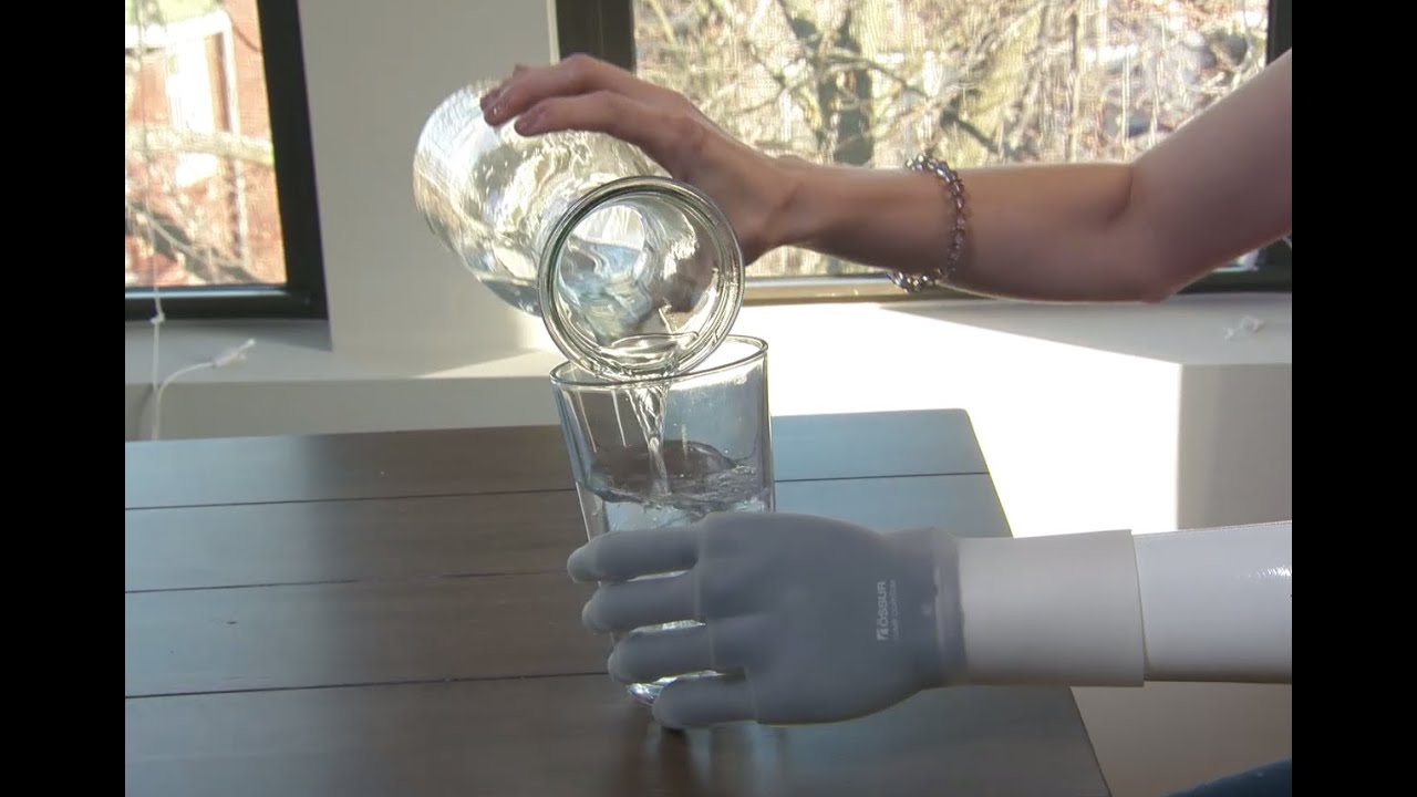 A Prosthetic Limb Innovation
