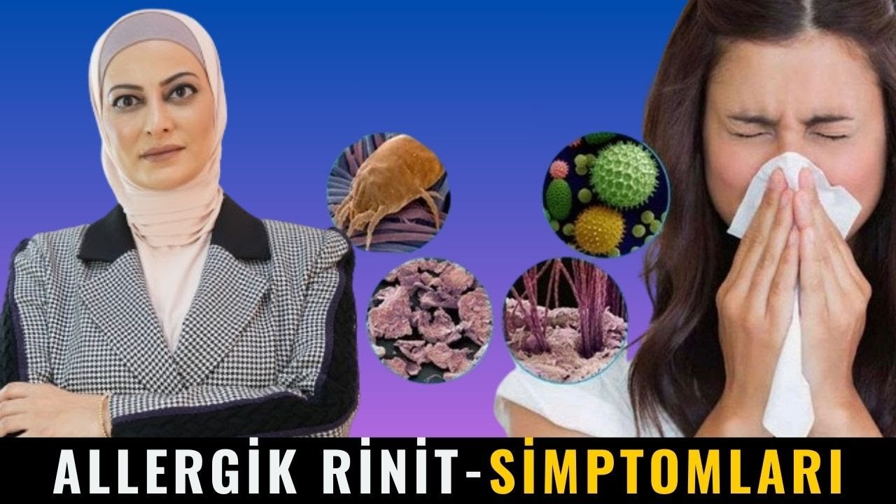 Baş Ağrısı, Əllərin Əsməsi.../ ALLERGİK RİNİT