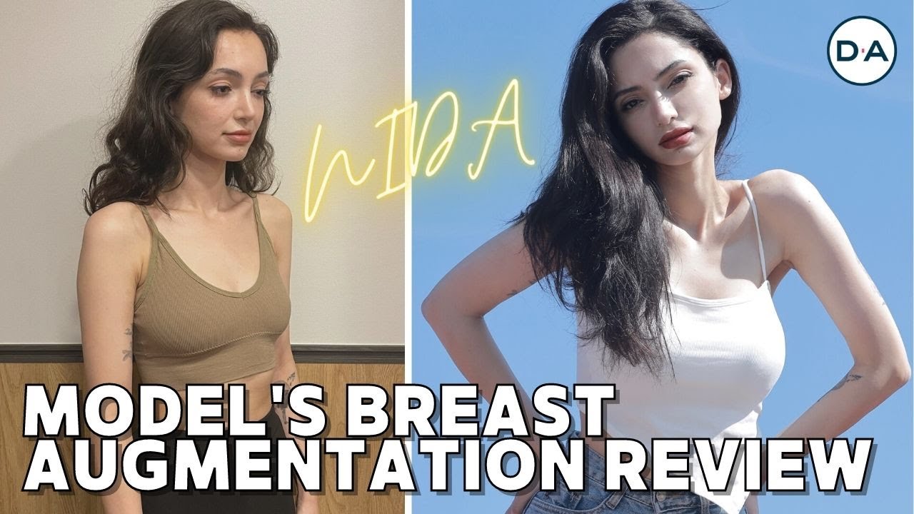 [Plastic Surgery Korea] Breast Augmentation Review From Model Nida