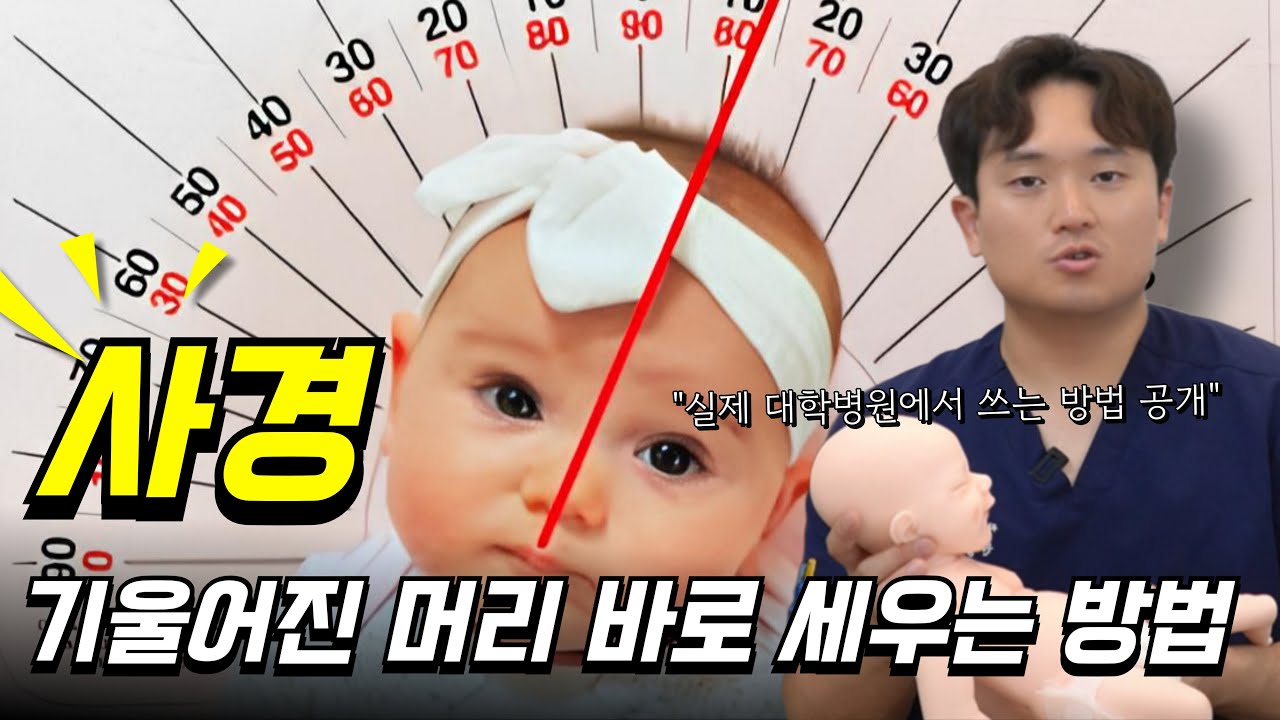 🫨한번에 사경 완치운동,조기발견 징후,관리법,예후까지! 멍울성 사경,자세성 사경,근성사경 스트레칭