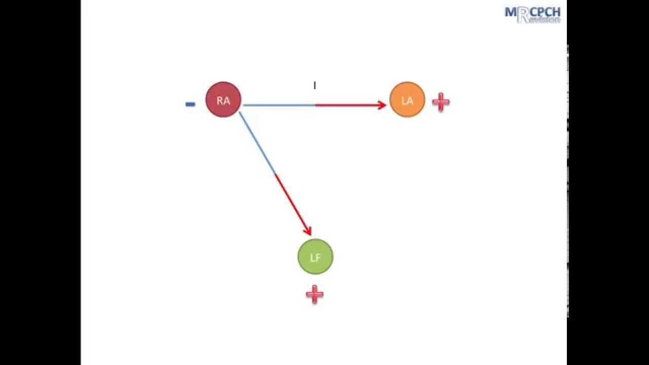 Where in the heart do ECG leads look?