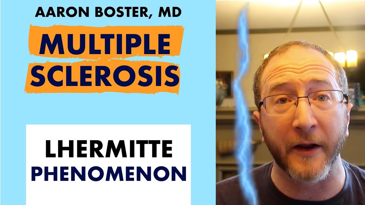 Multiple Sclerosis Pain Explained: Lhermitte Phenomenon