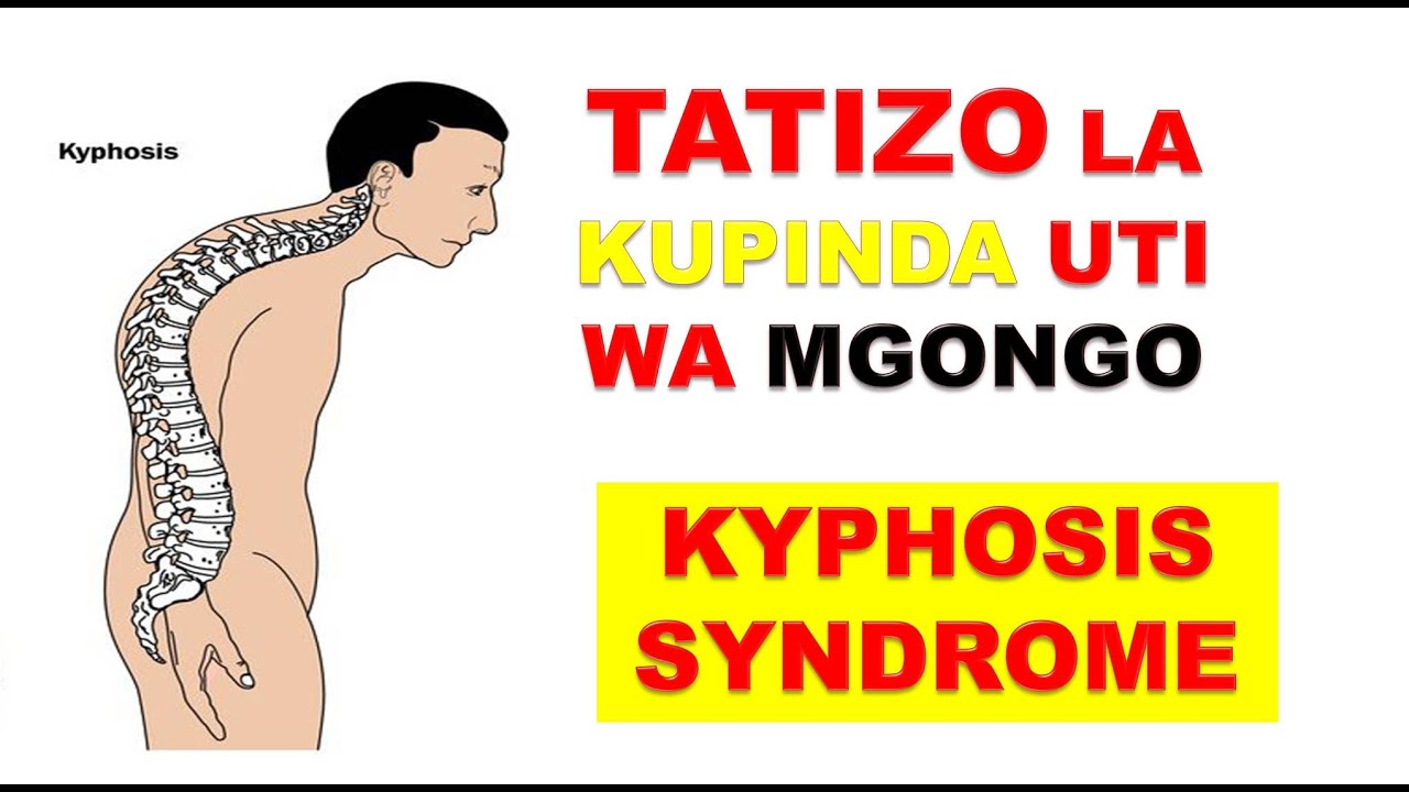 TATIZO LA KUPINDA UTI WA MGONGO | KYPHOSIS SYNDROME