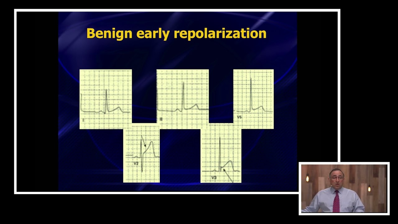 ECG Dilemma: BER, STEMI, or Pericarditis?