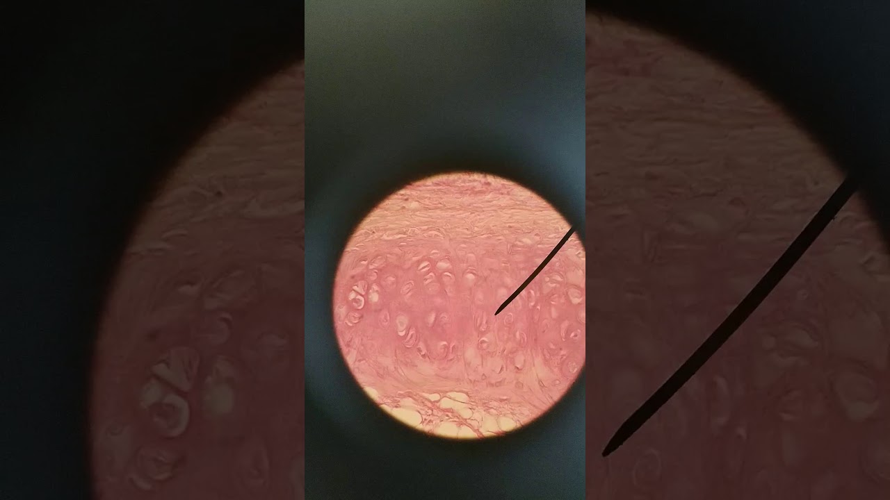 Respiratory histology and lung diseases