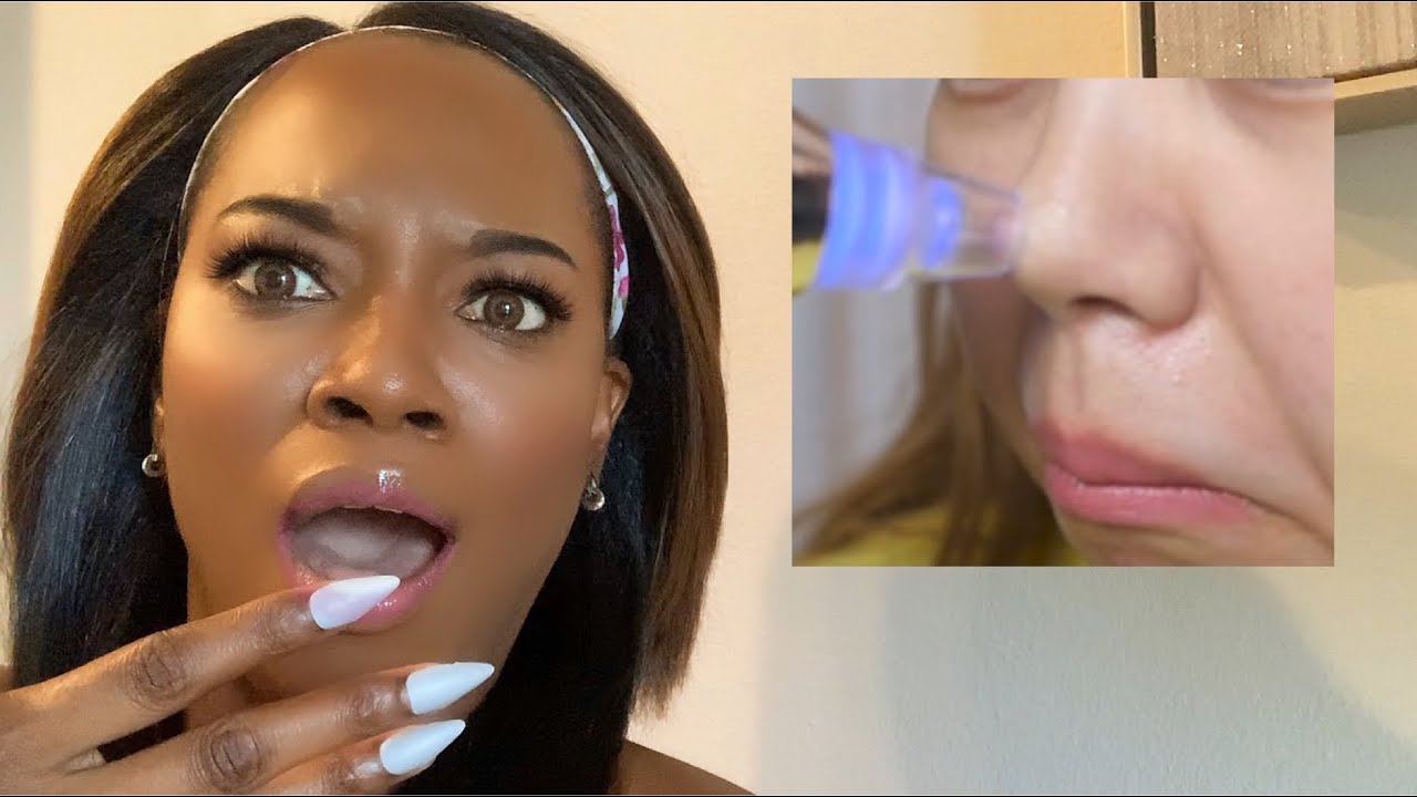 PORE VACUUMS?? | How to Get rid of Blackheads | SCIENTIST SEANKBEAUTY