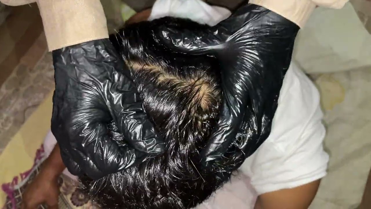 ASMR Head Injury Recovery Massage 🧠 Relaxing Scalp Therapy | ASMR DANU