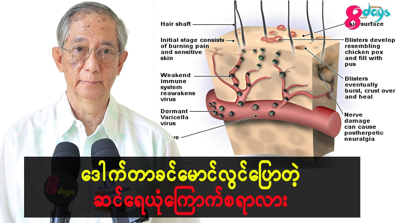 ဆရာကြီးဒေါက်တာခင်မောင်လွင်ပြောပြလာတဲ့