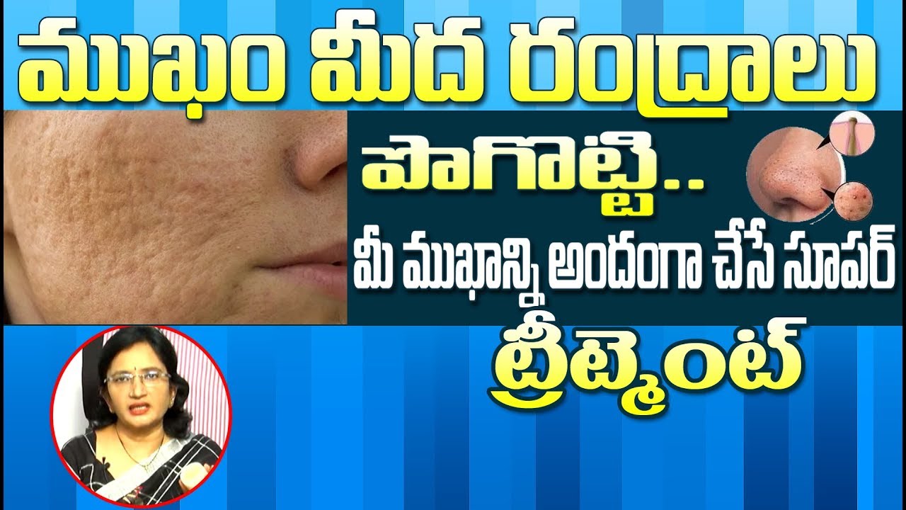 Open Pores Treatment l Get Flawless Skin in 4 Weeks l Lalitha Reddy l Hai TV