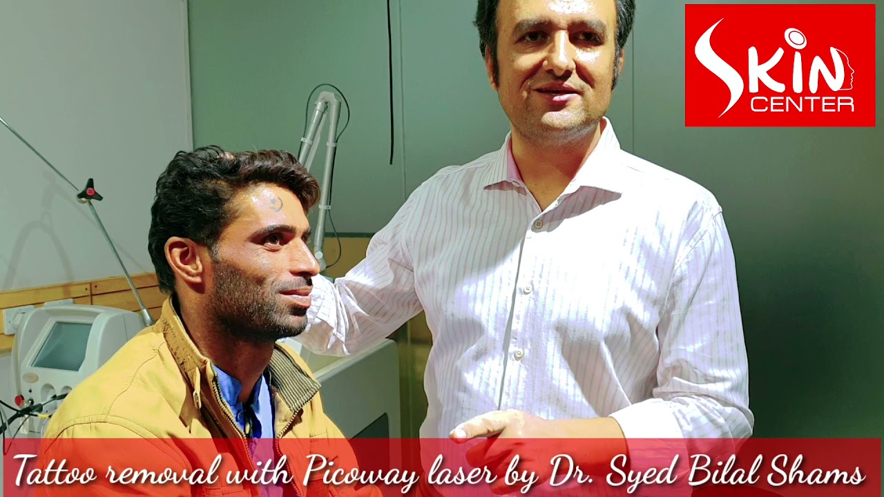 Tattoo removal with Picoway laser by skin specialist Dr. Syed Bilal Shams @skincenter.pakistan