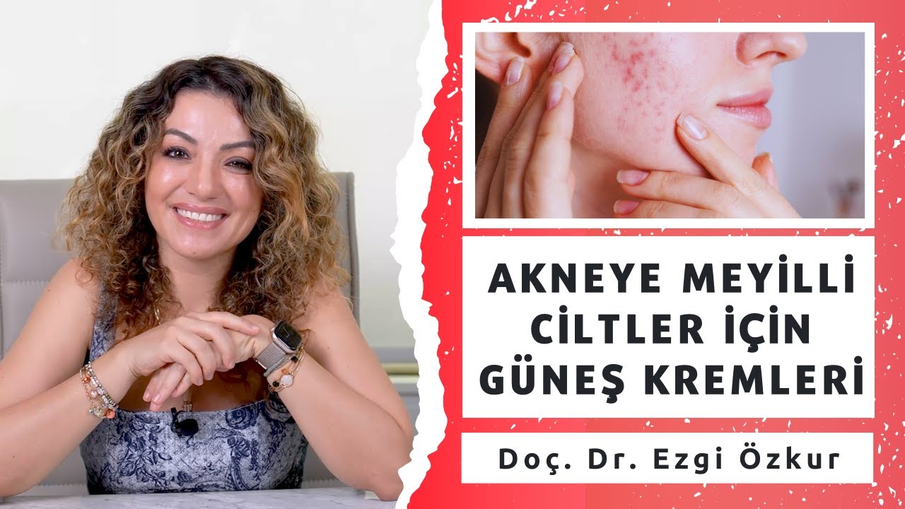 Akneye Meyilli Ciltler için Güneş Kremi Önerileri