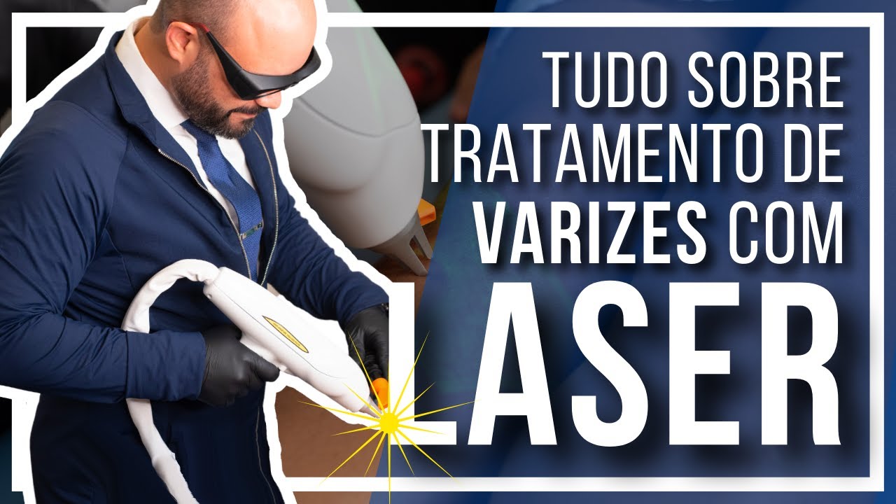 🔴 Tudo sobre o Tratamento de Varizes com LASER Transdérmico