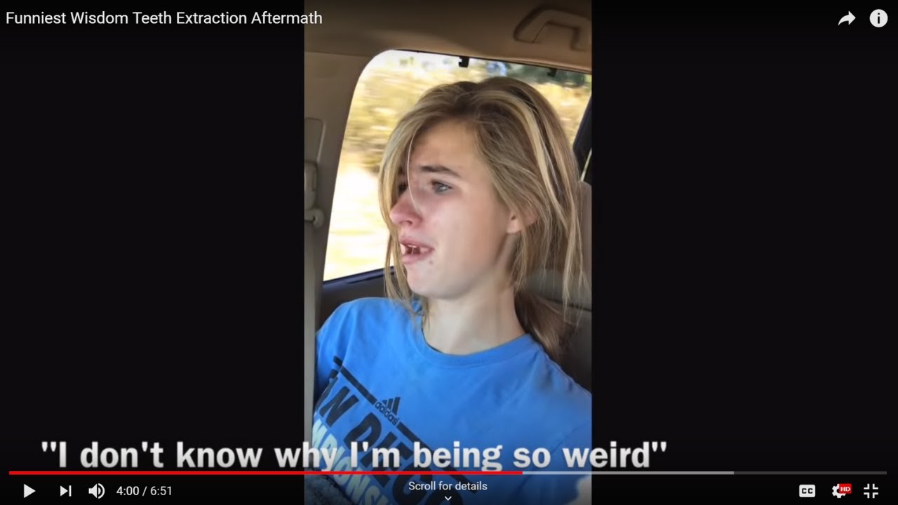Wisdom Teeth Removal Aftermath | Hilarious Anesthesia Recovery – Dad Pranks Daughter!