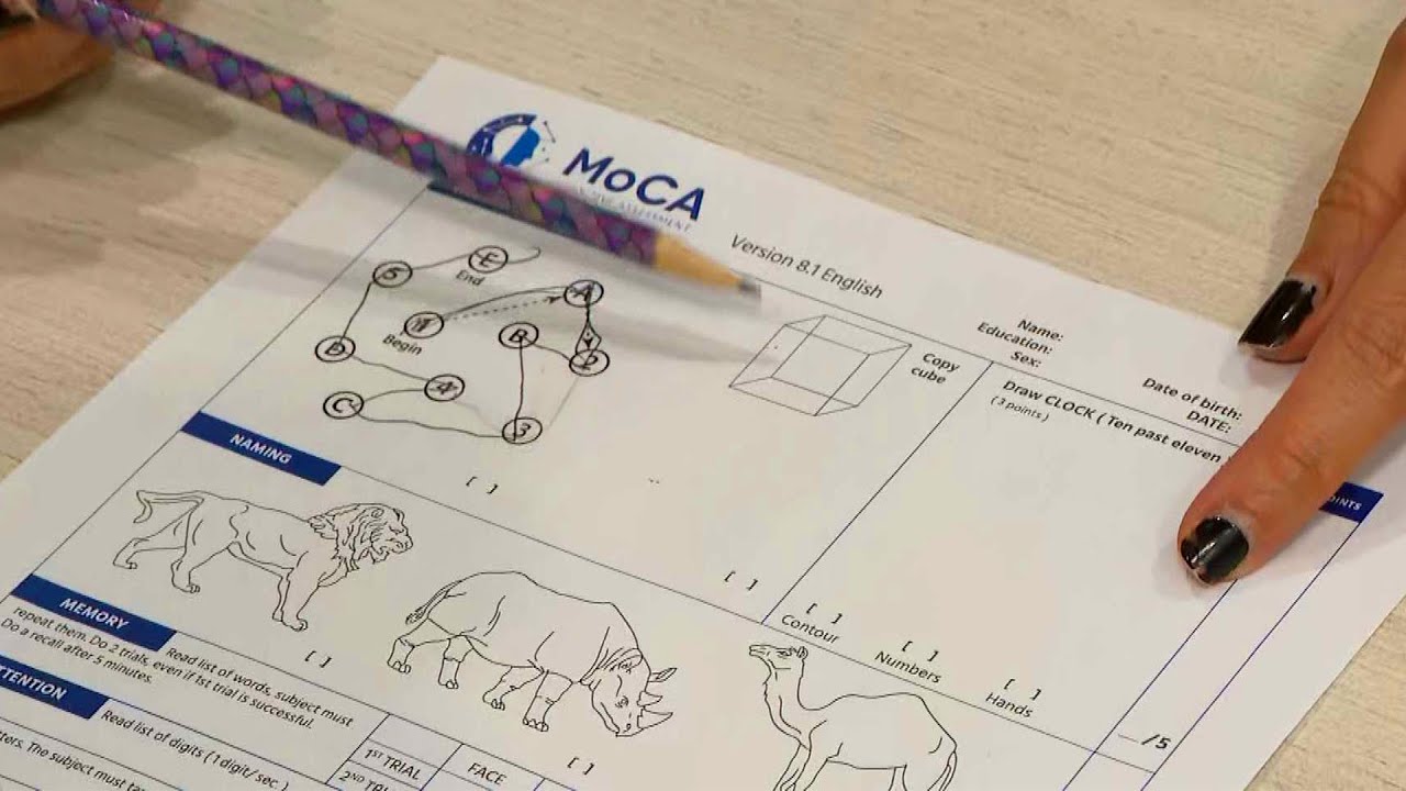 How Hard Is the Montreal Cognitive Assessment?