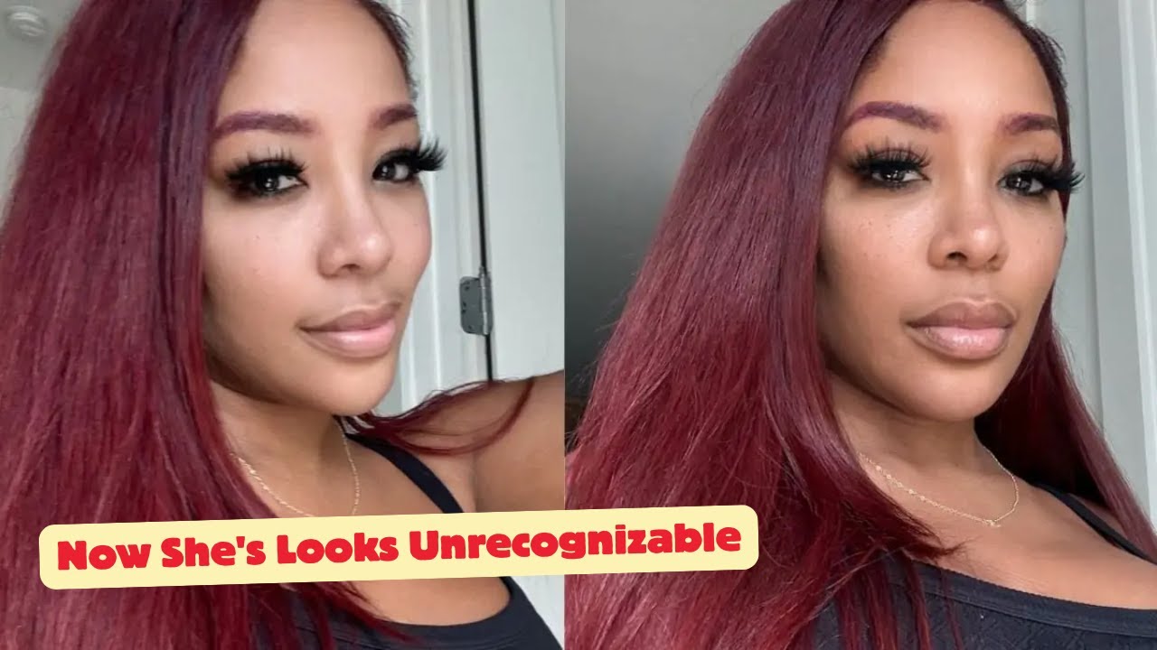 SHOCKING: K. Michelle Gets Plastic Surgery - Now She's Looks Unrecognizable!!