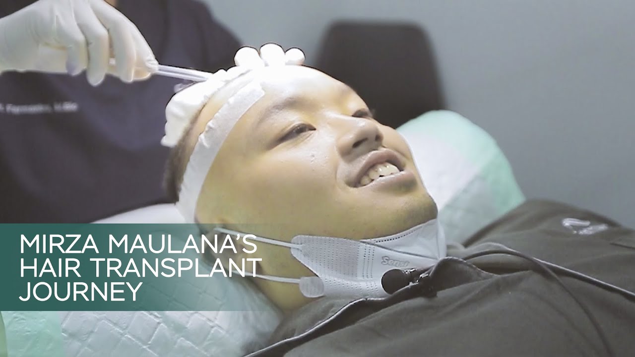 Mirza Hair Transplant Journey @farmaninaclinic