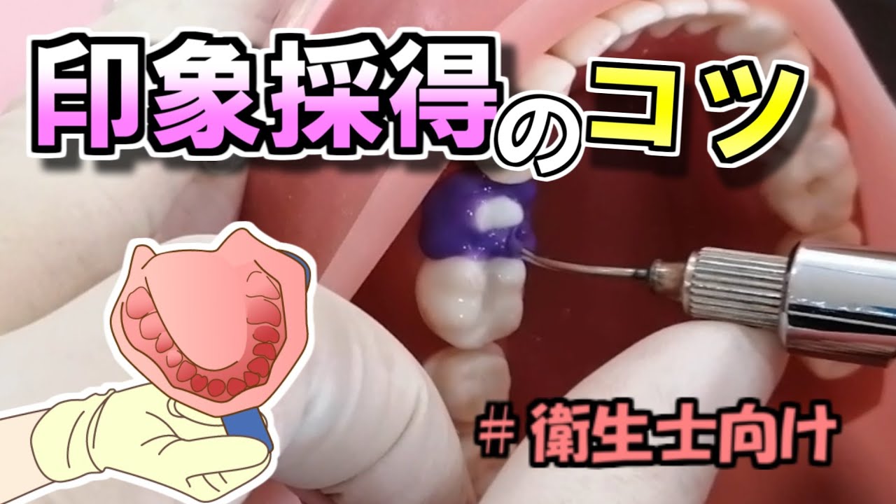㉖　【寒天アルジ】印象採得のコツ！
