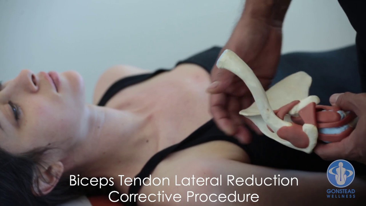 Dislocated Shoulder, Collar Bone , Biceps Tendon Adjustments and More -Dr Rahim Chiropractic