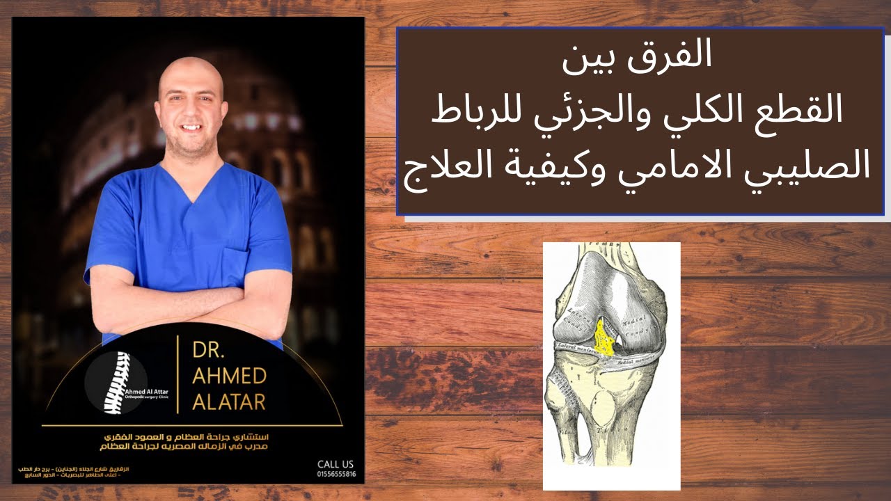 الفرق بين القطع الكلي والجزئي للرباط الصليبي الامامي وكيفية العلاج د العطار