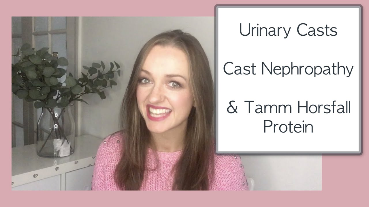 Urinary Casts, Cast Nephropathy & Tamm Horsfall Protein