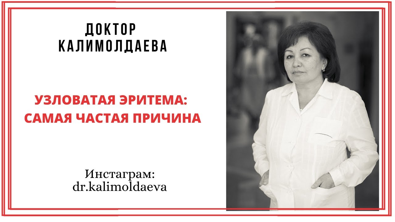 Узловатая эритема: самая частая причина